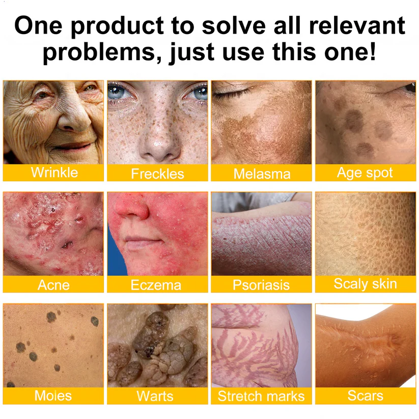 🔥FDA Approved: Bee Venom Pro Comprehensive Cream