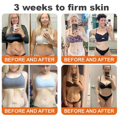 🔥FDA Approved: Bee Venom Pro Comprehensive Cream